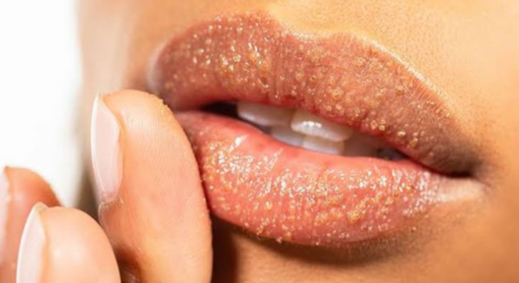 Anti Ribet dan Mudah Dibuat, Begini 3 Cara Membuat Scrub Bibir dari Bahan Alami