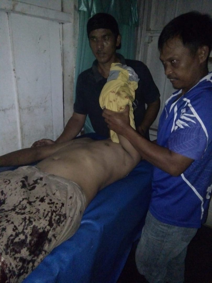 Karyawan Agricinal Putus Tangan Jalani Operasi