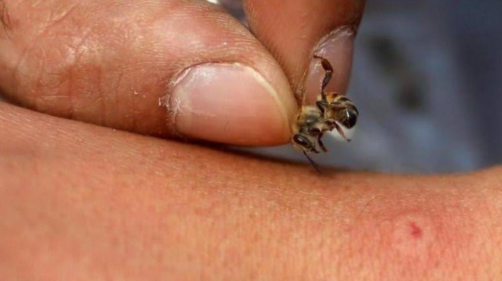 Seperti Ditusuk, Ini Pertolongan Pertama saat Disengat Lebah 