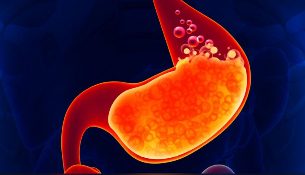 Kenali, Ini 7 Gejala Asam Lambung yang Tidak Boleh Dibiarkan 