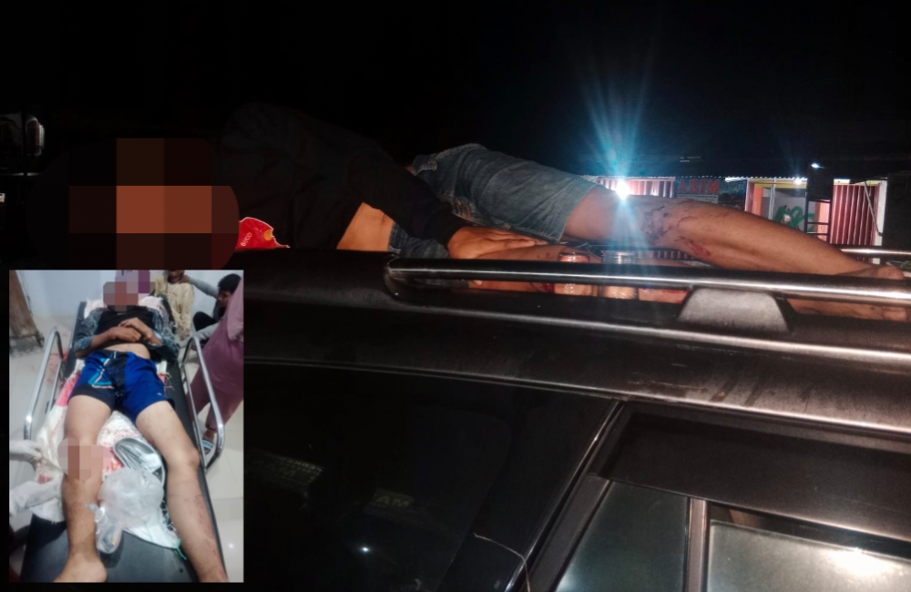 Laka Maut Jalinbar Putri Hijau, Warga Karang Pulau Tergilas Mobil Innova