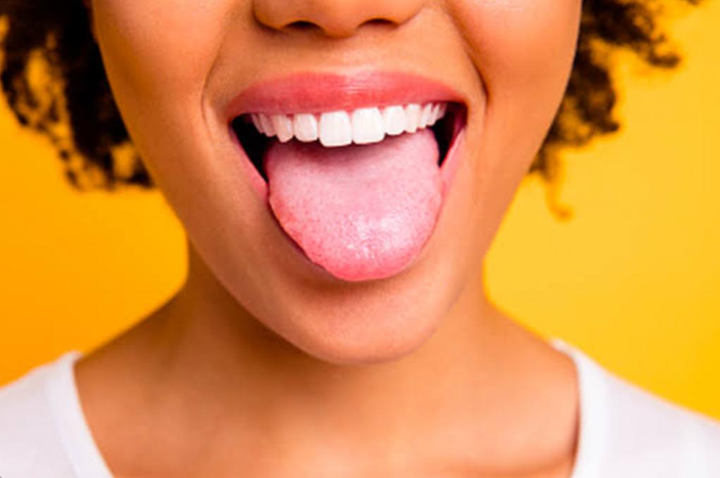 Tips Mengatasi Lidah Kebas Akibat Makanan Panas