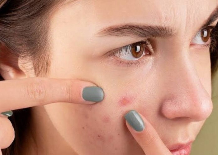 Mengganti Sarung Bantal Secara Rutin Ternyata Bisa Bantu Hilangkan Jerawat Loh