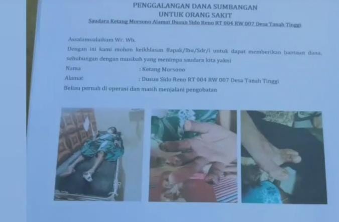 Penderita Penyumbatan Saluran Darah di Padang Jaya Butuh Uluran Tangan Dermawan