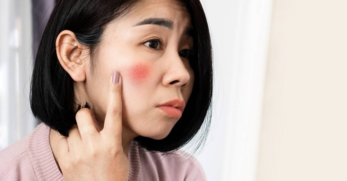 Kulit Mengelupas dan Memerah Setelah Pakai Retinol, Wajar Gak Sih? 