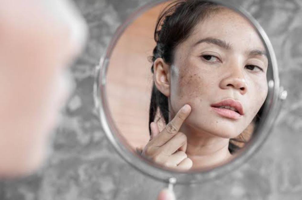 Waduh! 5 Kosmetik Ilegal Berisiko Kanker Kulit Dibongkar BPOM, Paling Banyak Dijual Online