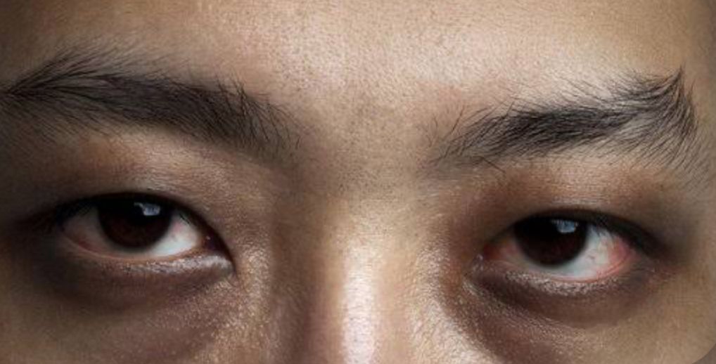 Doa Agar Terhindar dari Penyakit Ain: Latin, dan Artinya