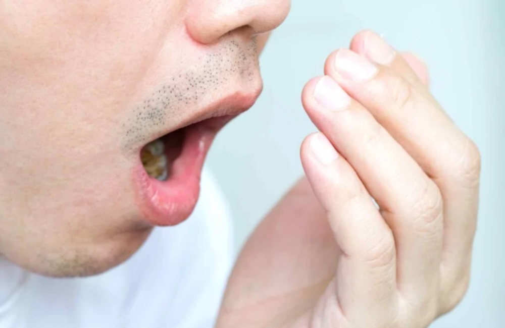 Bau Mulut No Way, Coba Obat Alami Ini Bau Mulut Anda Hilang