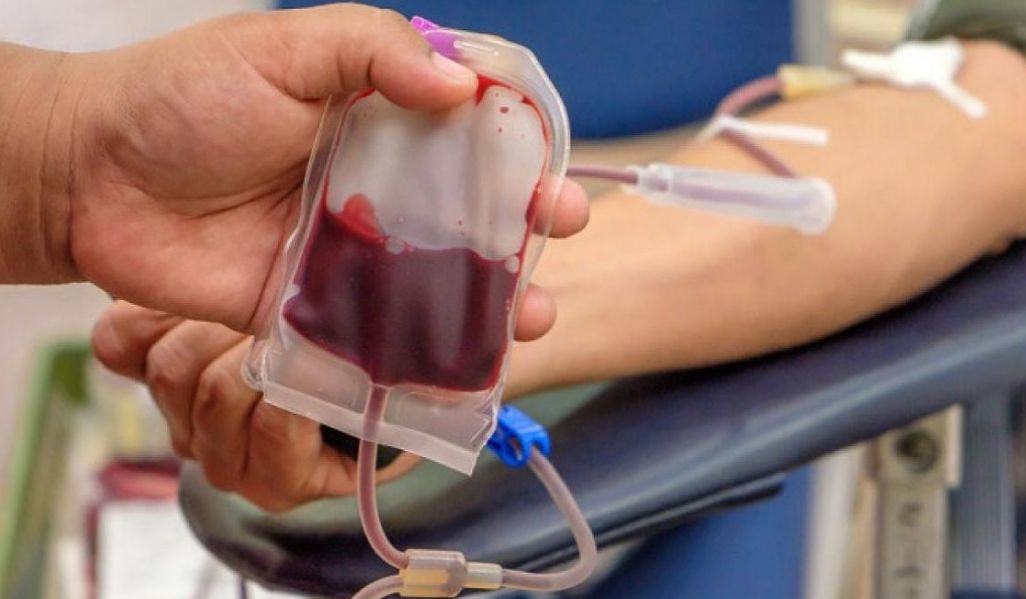Donor Darah Sebaiknya Dilakukan Berapa Bulan Sekali? Simak Jawabannya