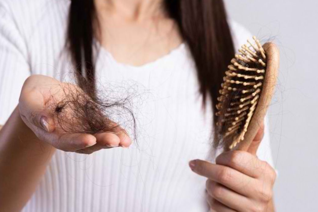 Waspadai, Ini 5 Penyakit yang Ditandai dengan Rambut Rontok Berlebihan