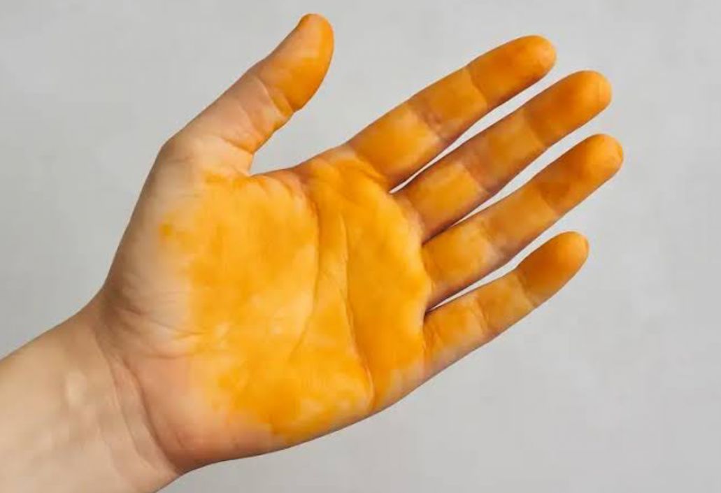 Cuma Pakai Bahan Dapur, Ini 4 Cara Mudah Menghilangkan Noda Kunyit di Tangan