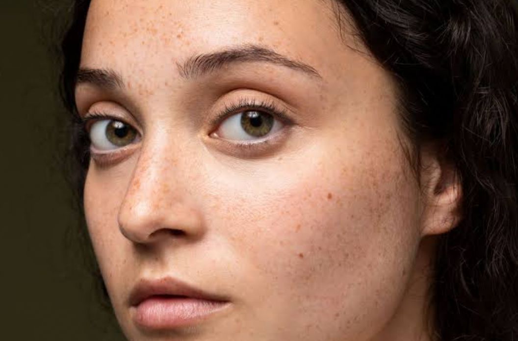 5 Tips Efektif Mengatasi Warna Kulit Wajah yang Tidak Merata