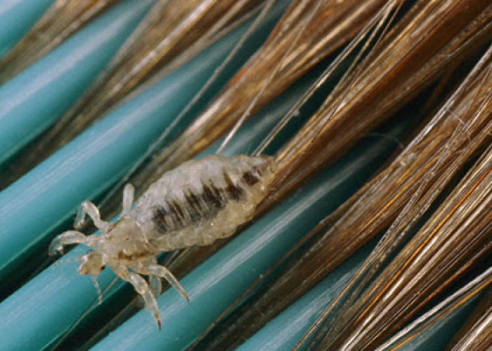 Ikuti Cara Ini, Dijamin Rambutmu Bisa Bebas dari Kutu yang Membandel 