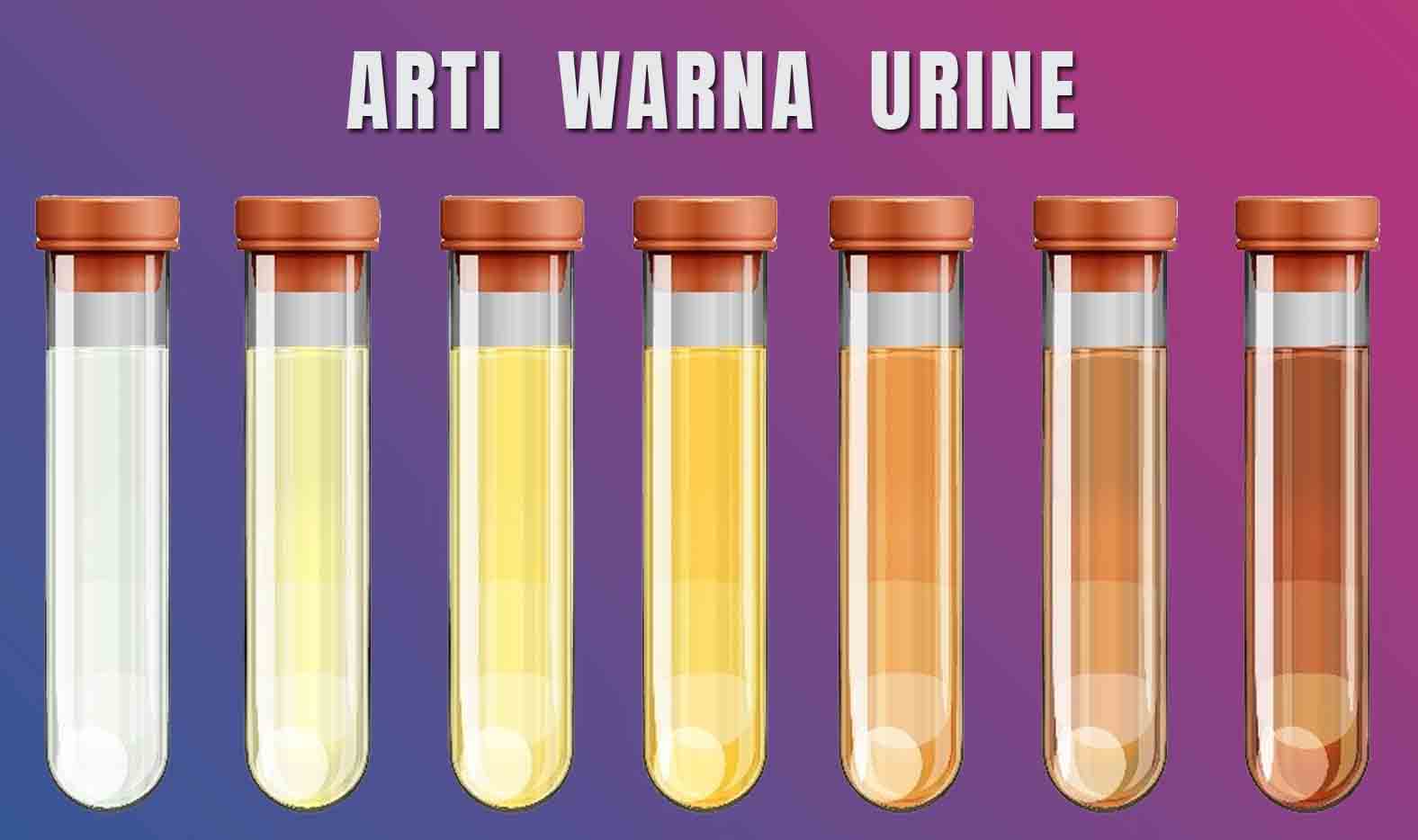 Ini Tanda Kesehatan Tubuh Dilihat dari Warna Urine