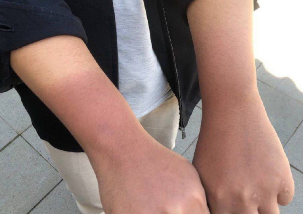 5 Tips Memilih Hand Body yang Bagus untuk Kulit Belang