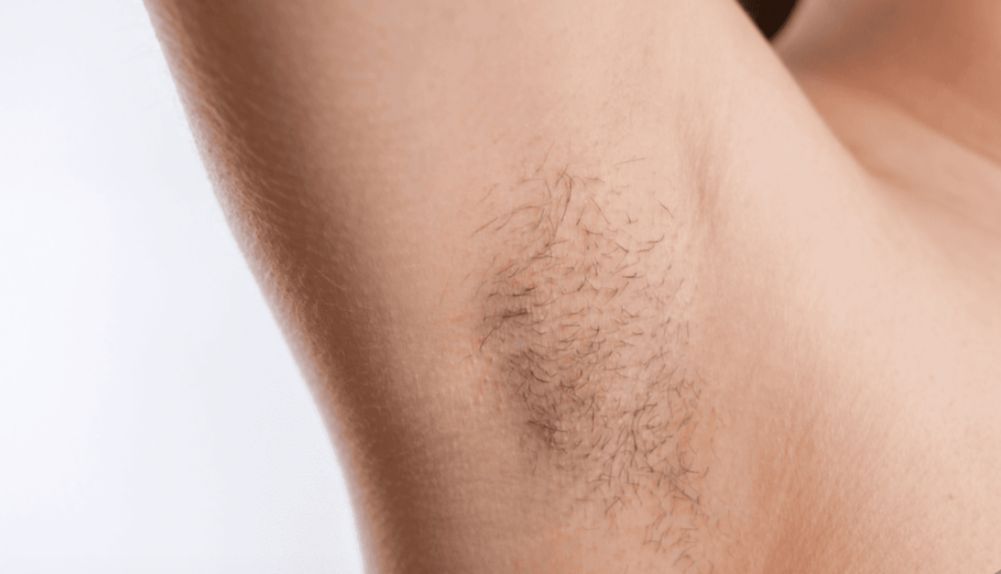 Ternyata Ada Manfaatnya, Ini 4 Alasan Kamu Tak Perlu Mencukur Bulu Ketiak