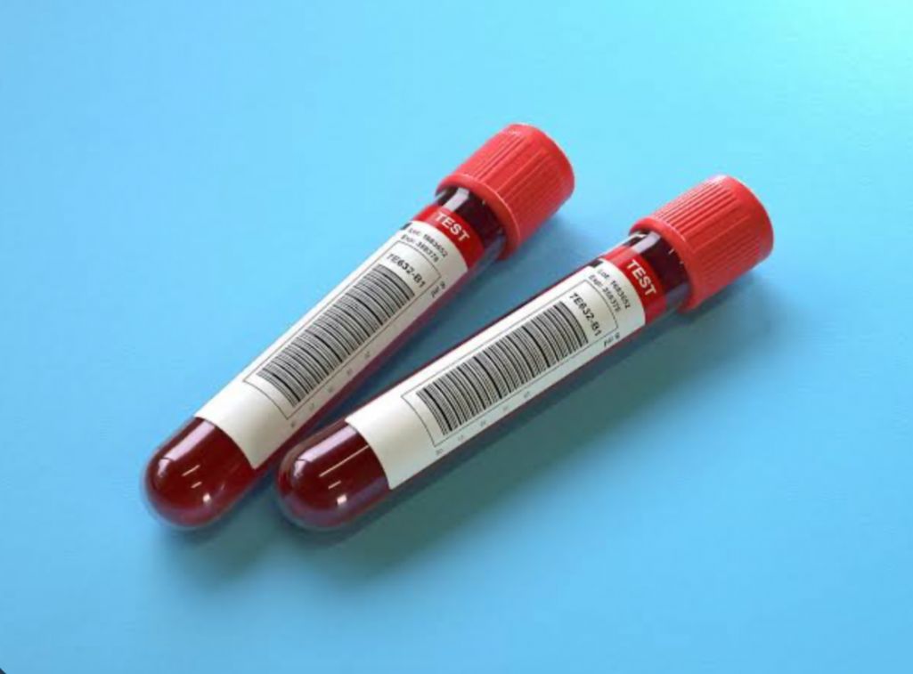 Cara Menaikkan Hb Darah dengan Cepat bagi Penderita Anemia