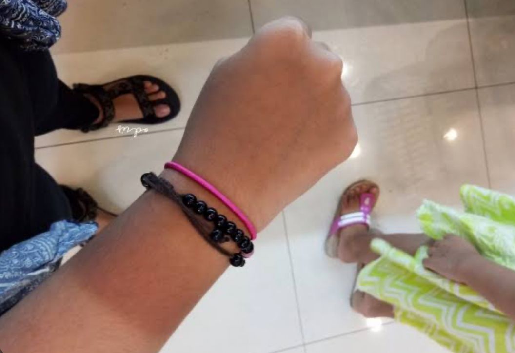 5 Cara Alami Mengatasi Kulit Gosong Akibat Sinar Matahari Hanya dengan Bahan Sederhana