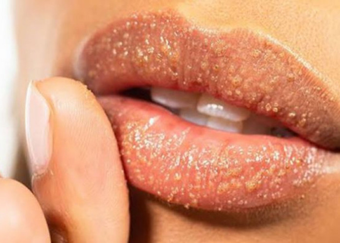 Anti Ribet dan Mudah Dibuat, Begini 3 Cara Membuat Scrub Bibir dari Bahan Alami