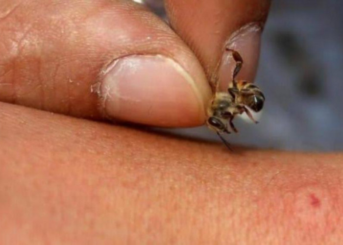 Seperti Ditusuk, Ini Pertolongan Pertama saat Disengat Lebah 