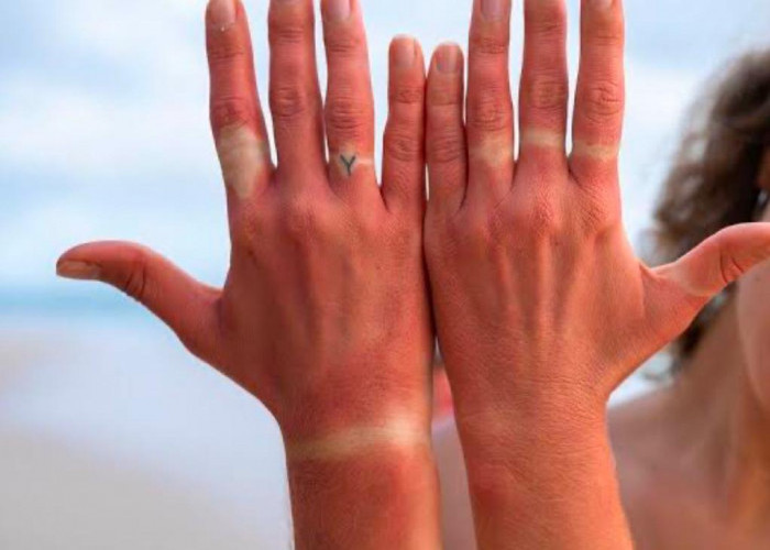 Bentuk Jari Tangan Ternyata Bisa Menentukan Karakteristik dan Keberuntungan