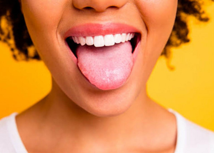 Tips Mengatasi Lidah Kebas Akibat Makanan Panas