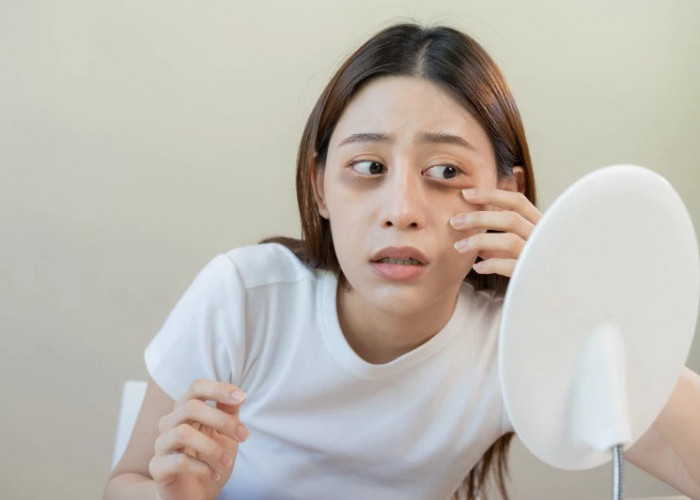 Selain Begadang, Ternyata Berjemur Juga Bisa Sebabkan Mata Panda Loh!