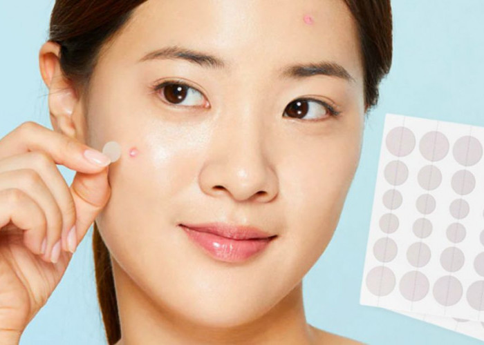 Ramai Dibahas, Apakah Acne Patch Efektif untuk Atasi Jerawat?