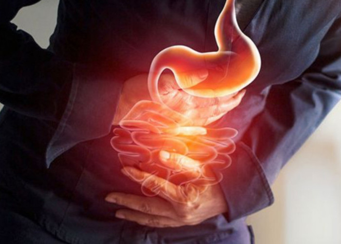 Tidak Perlu Langsung Beli Di Apotek, Kenali Obat Alami Asam Lambung Ampuh