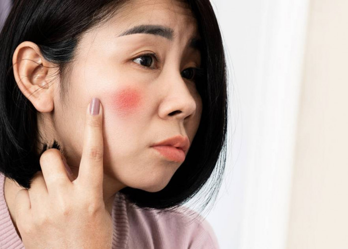 Kulit Mengelupas dan Memerah Setelah Pakai Retinol, Wajar Gak Sih? 