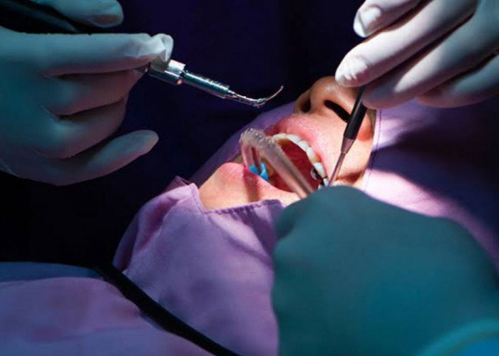 Scaling Gigi Bisa Pakai BPJS Kesehatan, Begini Syarat dan Prosedurnya