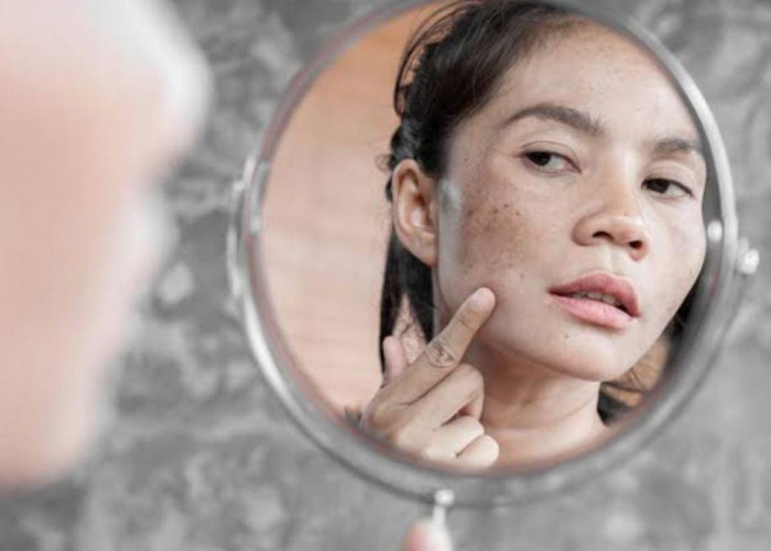 Waduh! 5 Kosmetik Ilegal Berisiko Kanker Kulit Dibongkar BPOM, Paling Banyak Dijual Online