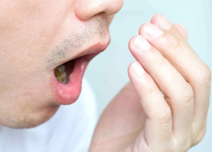 Bau Mulut No Way, Coba Obat Alami Ini Bau Mulut Anda Hilang