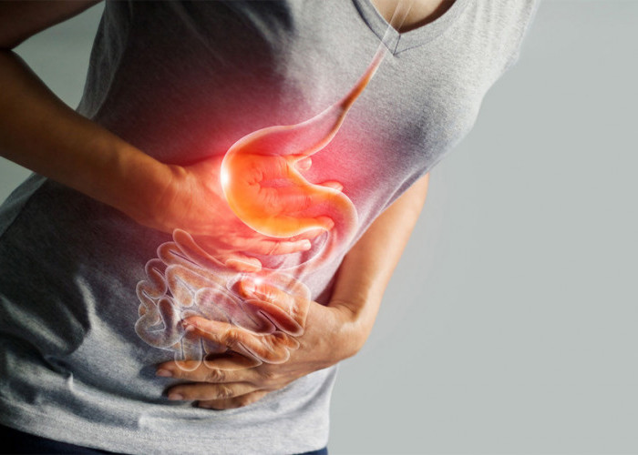 Jika Ada Yang Murah dan Mudah Didapatkan, Kenapa Harus yang Mahal, Ini Obat Tradisional Sakit Maag Ampuh