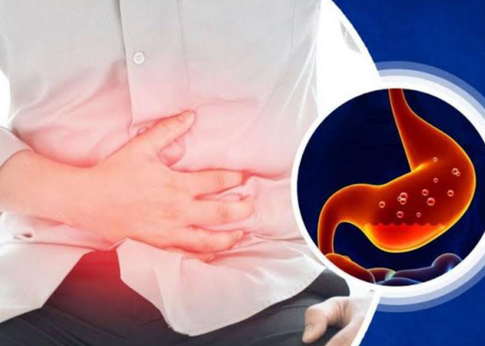 Cegah Penyakit Maag Kambuh Selama Puasa, dengan Melakukan Tips Berikut Ini