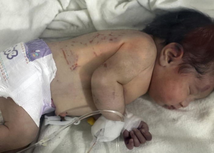 Seorang Bayi Lahir Selamat di Bawah Reruntuhan Akibat Gempa Dahsyat Turki dan Suriah