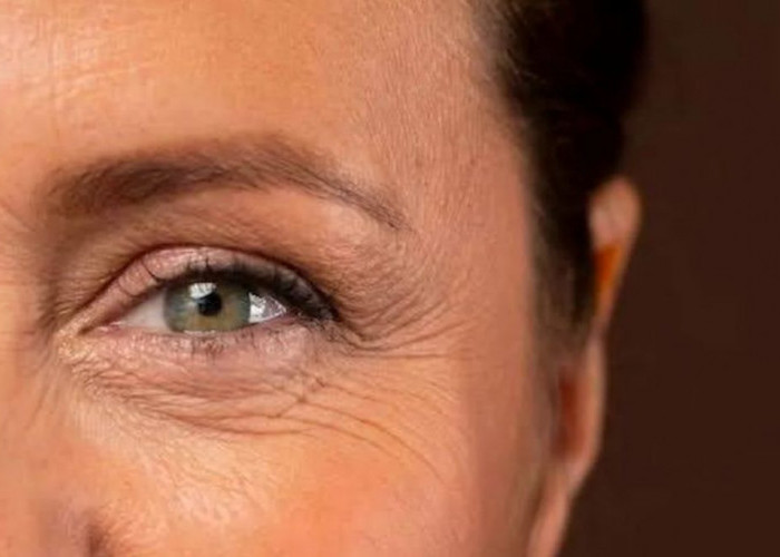 Ternyata Ini 7 Penyebab Keriput di Bawah Mata yang Bikin Wajah Tampak Tua