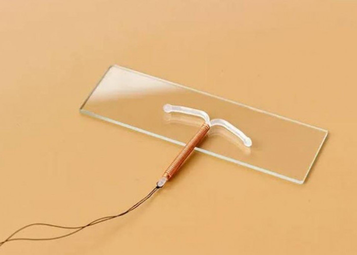 Jadi Favorit Kaum Ibu, Ternyata Ini Penyebab Pengguna IUD Kebobolan