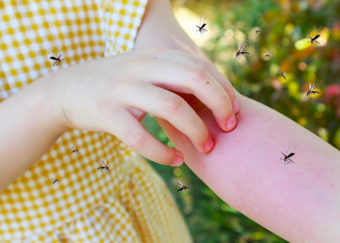 4 Jenis Orang ini Sangat Disukai Oleh Nyamuk, Wajib Siapkan Stok Obat  Nyamuk
