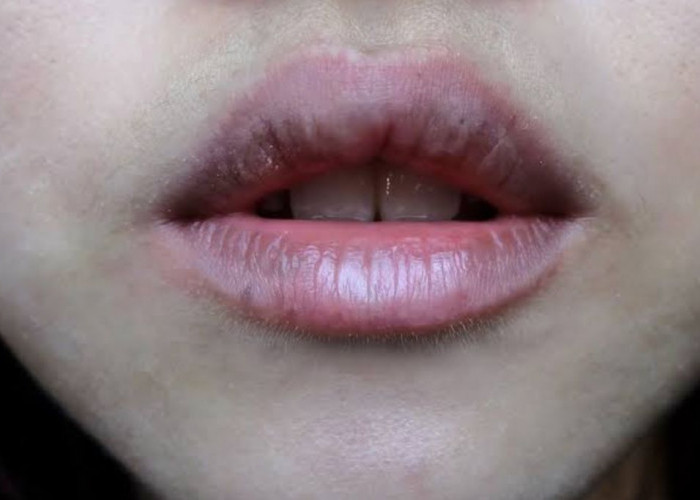 Selain Jeruk Nipis, Ternyata Ada Bahan Alami Lain yang Bisa Bantu Cerahkan Bibir HItam