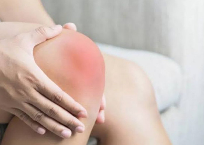 Tips Ampuh Mengobati Rasa Sakit Pada Bagian Sendi Lutut