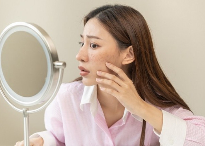 Racikan Masker Cuka Sari Apel yang Bisa Hilangkan Flek Hitam