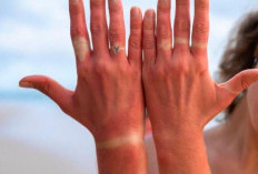 Bentuk Jari Tangan Ternyata Bisa Menentukan Karakteristik dan Keberuntungan