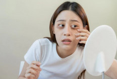 Selain Begadang, Ternyata Berjemur Juga Bisa Sebabkan Mata Panda Loh!