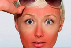 Rekomendasi Produk Skincare untuk Menghilangkan Belang di Wajah