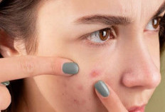 Mengganti Sarung Bantal Secara Rutin Ternyata Bisa Bantu Hilangkan Jerawat Loh