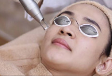 Tidak Butuh Waktu Lama, Berikut ini Langkah Menghilangkan Flek Hitam di Wajah Secara Alami