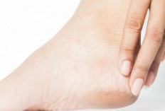 Tak Hanya Karena Kebanyakan Berdiri, Nyeri di Tumit Juga Bisa Disebabkan Hal Ini