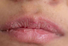 Tanpa Disadari, Ini 6 Kebiasaan Sehari-hari yang Bikin Bibir Kering dan Mengelupas