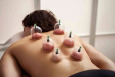 Efek Samping Menjalani Terapi Bekam yang Perlu Diperhatikan 